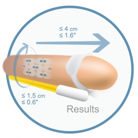  SVILUPPATORE PENE ANDROEXTENDER 